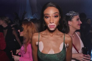Winnie Harlow