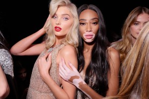 Elsa Hosk and Winnie Harlow