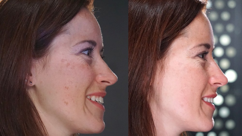 Face Time at CES: For P&G, L’Oréal and Neutrogena, Skin Is Still In