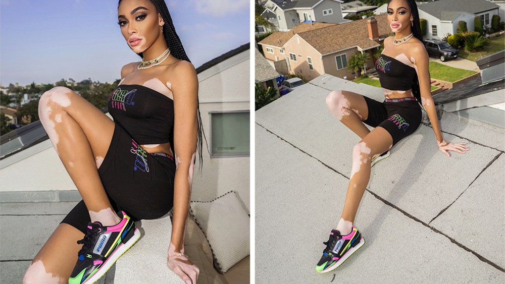 Winnie Harlow on her roof at home.