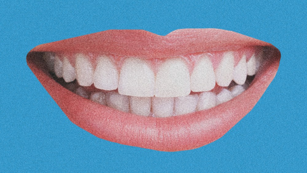 What's Behind the Boom in Teeth Alignment